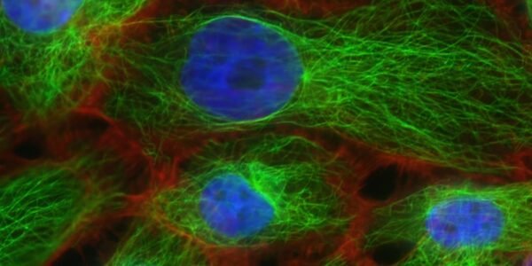 Dis-ease and our State of Well-Being Dis-ease and our State of Well-Being