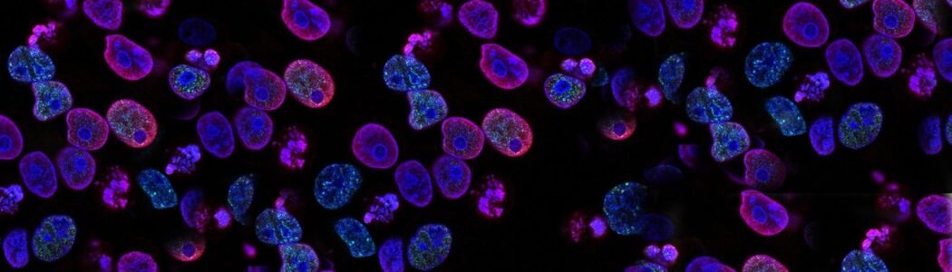 Exploring Cancer Through Astral Projection