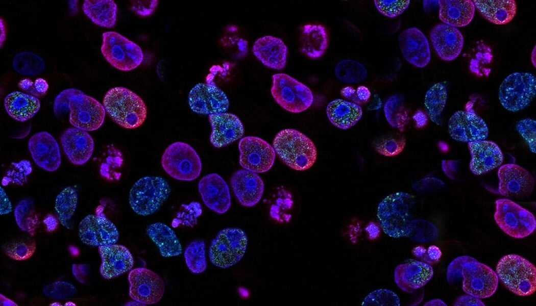 Exploring Cancer Through Astral Projection