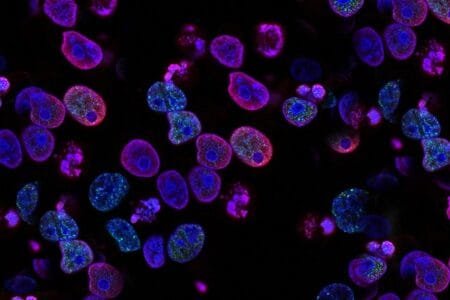 Exploring Cancer Through Astral Projection Exploring Cancer Through Astral Projection