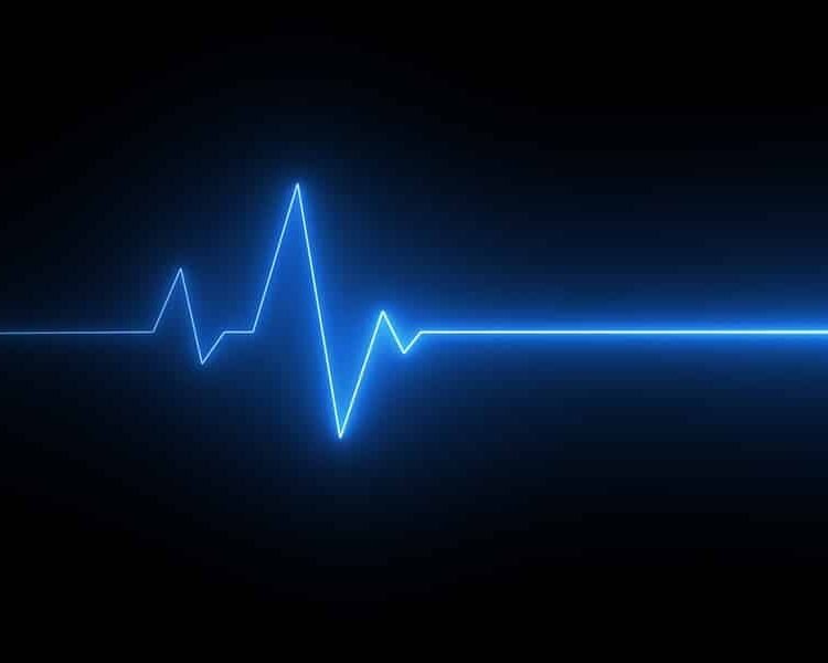 The Day My Heart Stopped • What It Felt Like To Die
